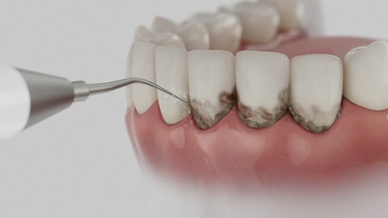 Reliable Dental Implants contractor in Hamilton, OH by Smile Center Dentistry